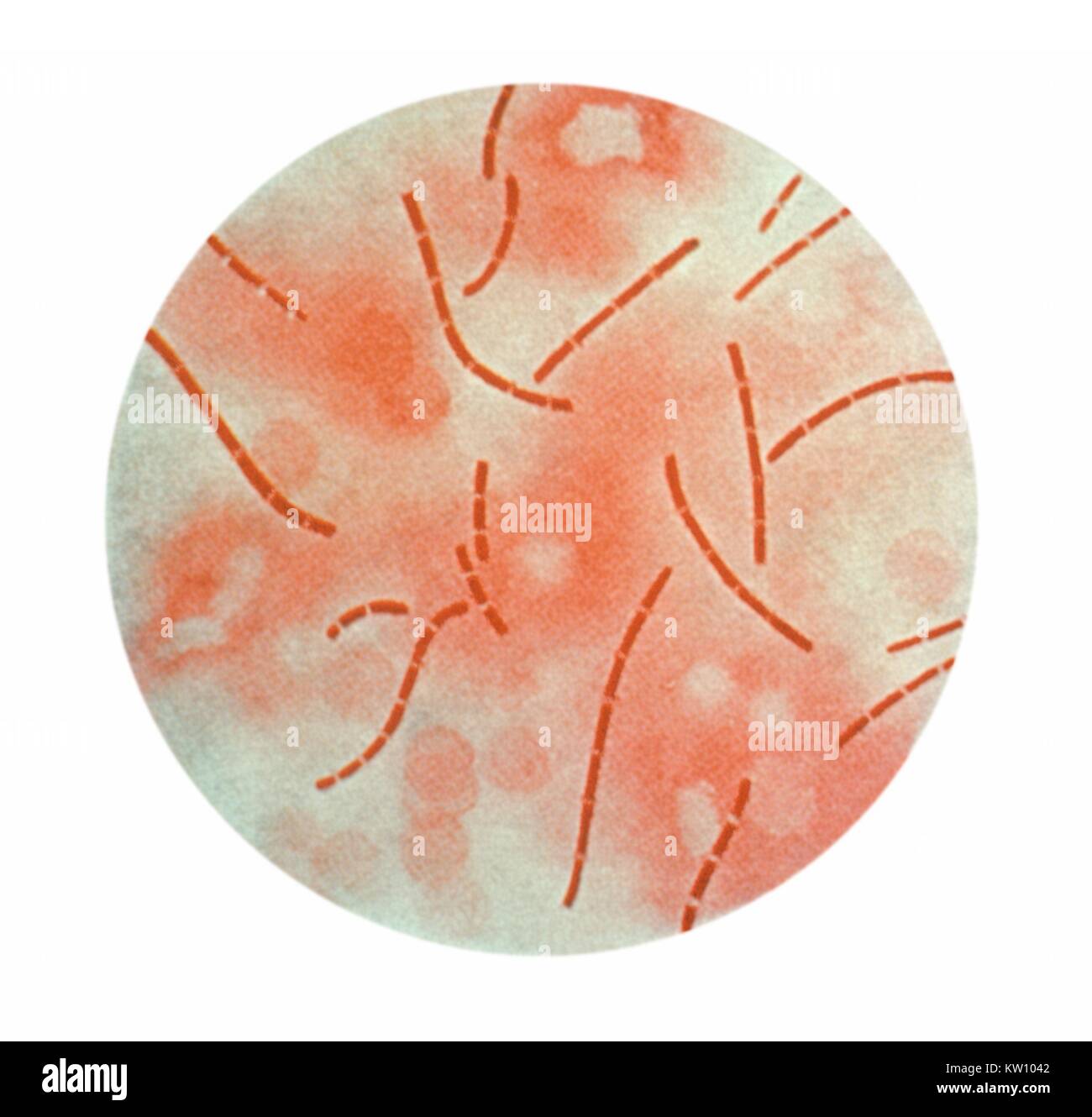 Cette illustration présente une vue photomicrographique de bactéries Bacillus anthracis prises de sang du cœur, et à l'aide de fuchsine phéniquée-. B. anthracis, la cause de l'Anthrax, est habituellement due à une exposition professionnelle à des animaux infectés ou leurs produits. Image courtoisie CDC, 1979. Banque D'Images