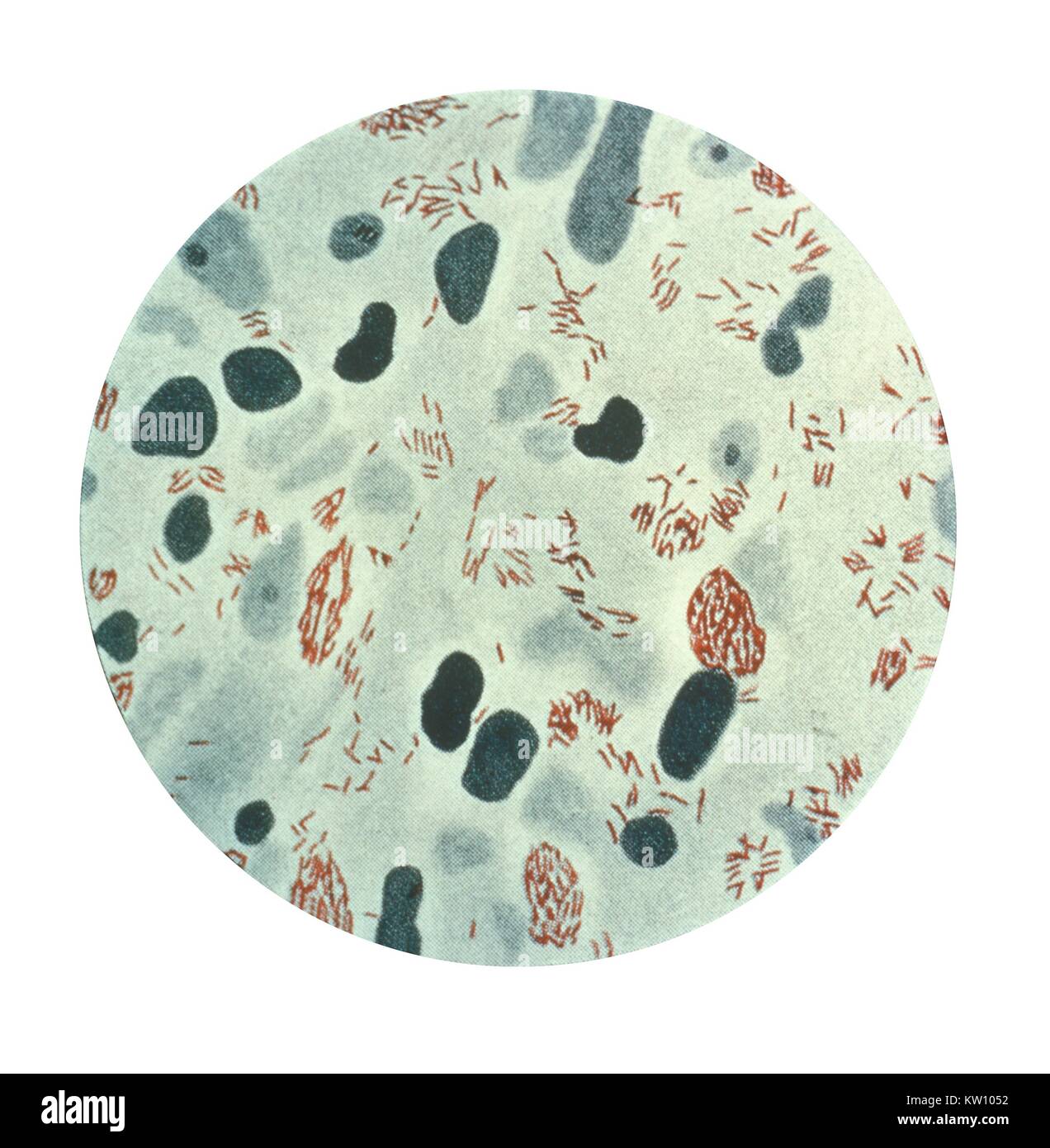 Cette illustration présente une vue photomicrographique de Mycobacterium leprae bactérie prises à partir d'une lésion cutanée lépromateuse. M. leprae est la cause de la lèpre ou maladie de Hansen. Un ralentissement de la multiplication de bactéries, elle affecte principalement la peau, les nerfs et les muqueuses. En 1999, le monde l'incidence a été estimé à 640, 000, et en 2000, 738, 284 cas ont été identifiés. Image courtoisie CDC, 1979. Banque D'Images