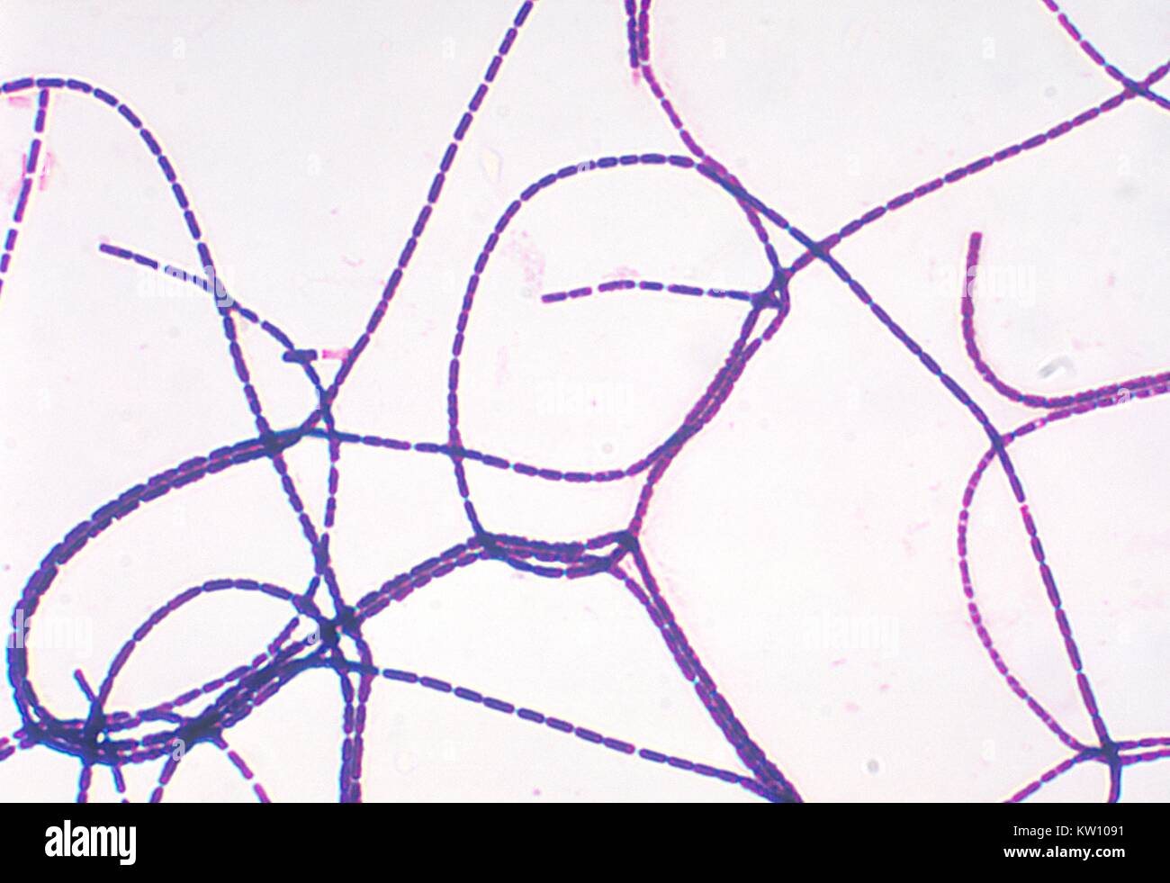 Une Photomicrographie Montrant Une Coloration De Gram Positif Avec Bacillus Anthracis La Maladie Du Charbon Est Diagnostiquee Par L Isolement De B Anthracis A Partir Du Sang Des Lesions De La Peau Une Photomicrographie Montrant Une Coloration De Gram Positif Avec Bacillus Anthracis La Maladie Du Charbon Est Diagnostiquee Par L Isolement De B Anthracis A Partir Du Sang Des Lesions De La Peau