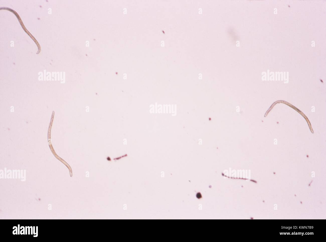 Il s'agit d'un montage glycérine photomicrographie de l'Onchocerca volvulus pathogène microfilarial dans sa forme larvaire, 1975. O. volvulus, le parasite filarien responsable de l'onchocercose, la cécité ou ?. ?, est transmise à son hôte humain par la morsure de Simulium spp. de mouches comme la mouche noire. Image courtoisie CDC/Ladene Newton. Banque D'Images