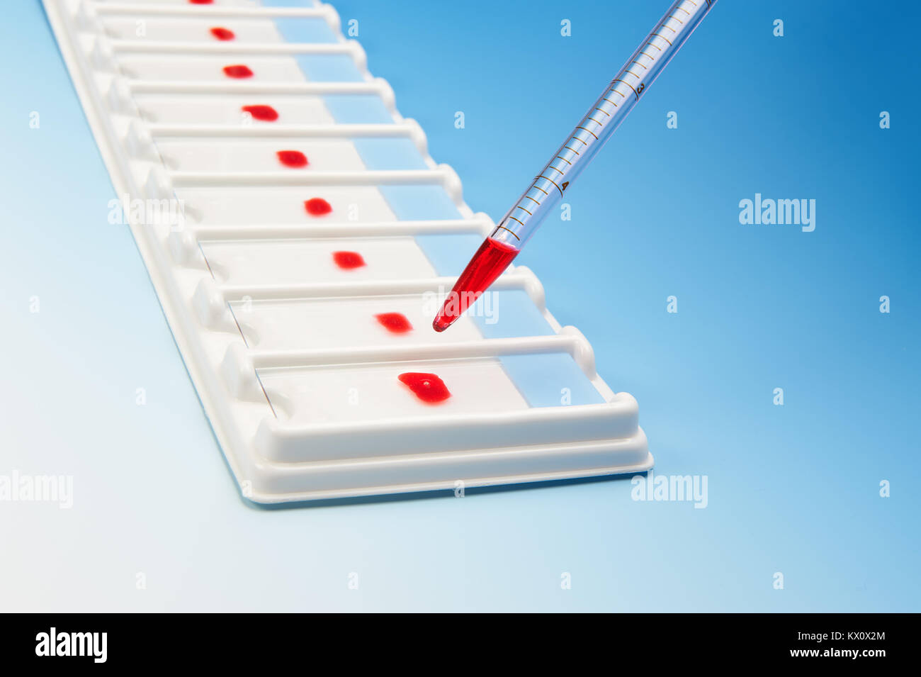 Concept d'essais biologiques. Gamme d'échantillons de sang pour microscopie électronique et d'une pipette sur fond dégradé bleu Banque D'Images