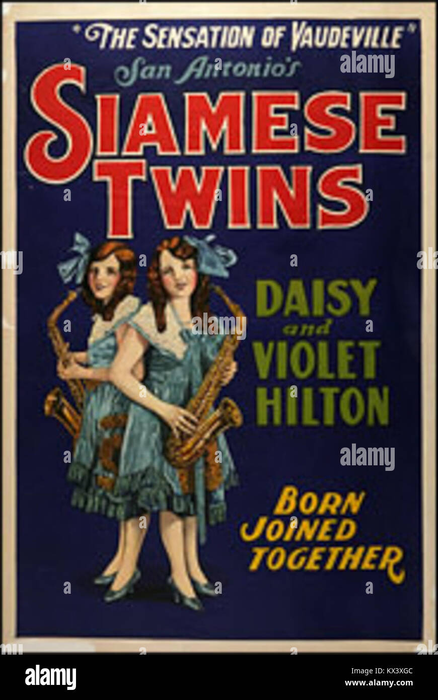 Affiche mettant en vedette Daisy et Violet Hilton, jumelles conjointes, promouvant des apparitions publiques en 1920. Banque D'Images