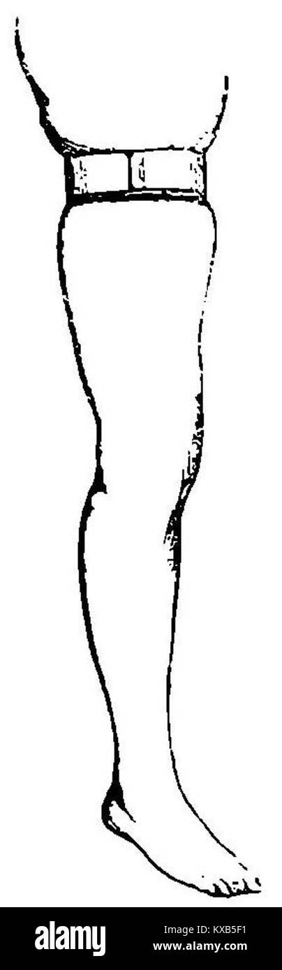 Cette image représente une étude anatomique axée sur la compression mécanique de l’artère fémorale, un aspect clé dans la recherche médicale et la compréhension de la santé vasculaire. Banque D'Images Cette image représente une étude anatomique axée sur la compression mécanique de l’artère fémorale, un aspect clé dans la recherche médicale et la compréhension de la santé vasculaire. Banque D'Images
