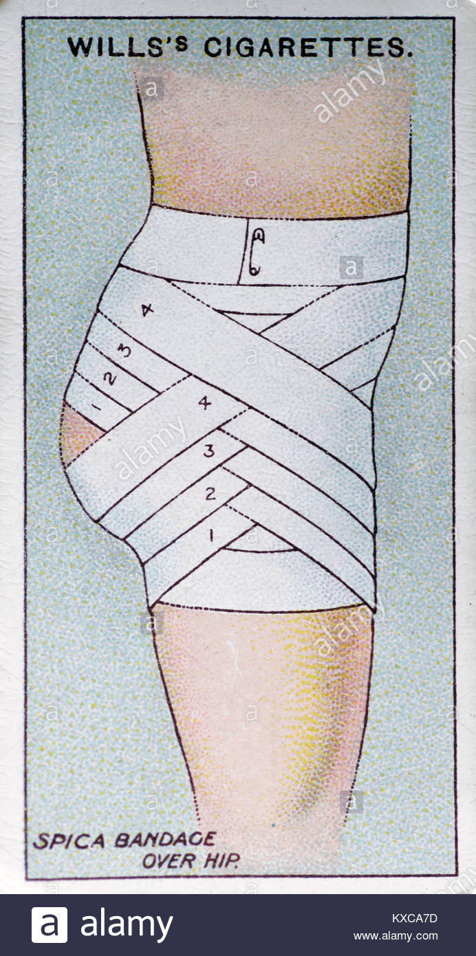 Bandage spica sur la hanche Banque de photographies et d’images à haute