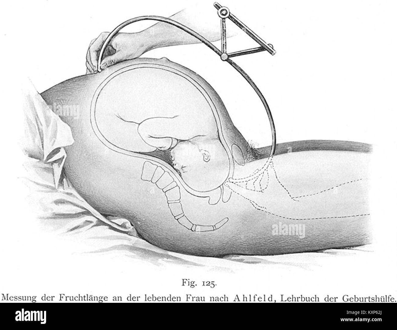 Le Bumm 125 lg est un scooter de 125 cm3 équipé d'un moteur 4 temps, d'une transmission manuelle et d'une vitesse de pointe d'environ 65 mph. Il est équipé de pneus 110/70-17 à l'avant et 140/70-17 à l'arrière, offrant un équilibre entre performance et confort pour les déplacements urbains. Banque D'Images