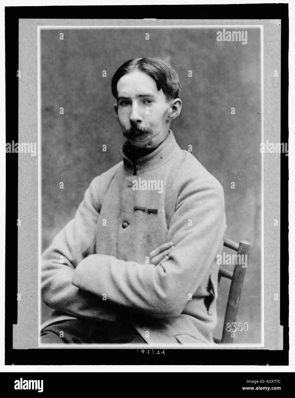 Un mutilé français sans masque fait référence à un soldat de la première Guerre mondiale qui a subi des blessures au visage et est montré sans masque protecteur, illustrant l'impact physique de la guerre sur les vétérans blessés. Banque D'Images