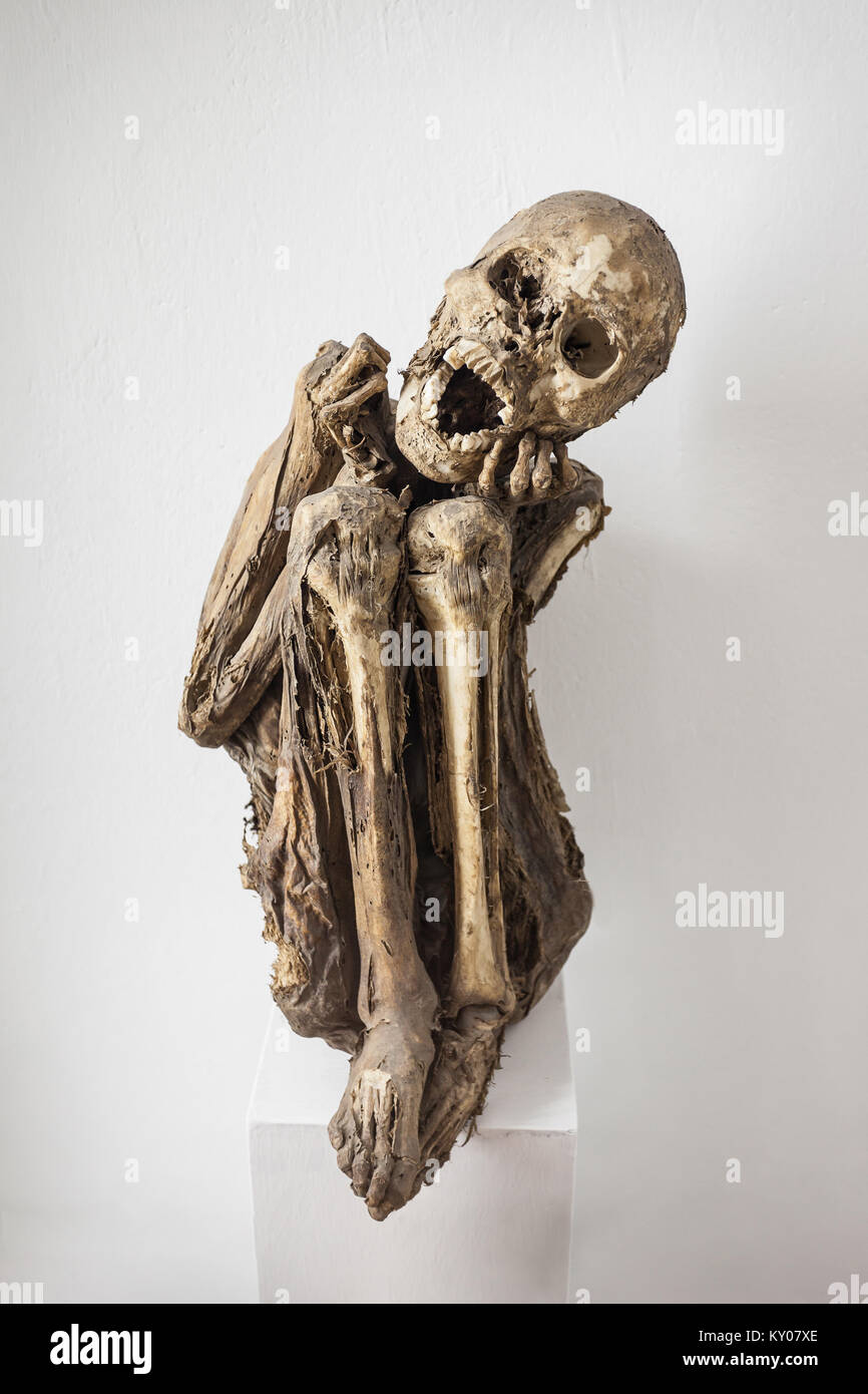 HUARAZ, PÉROU - 29 MAI 2015 : cadavre humain momifié dans Huaraz Museum au Pérou. Banque D'Images