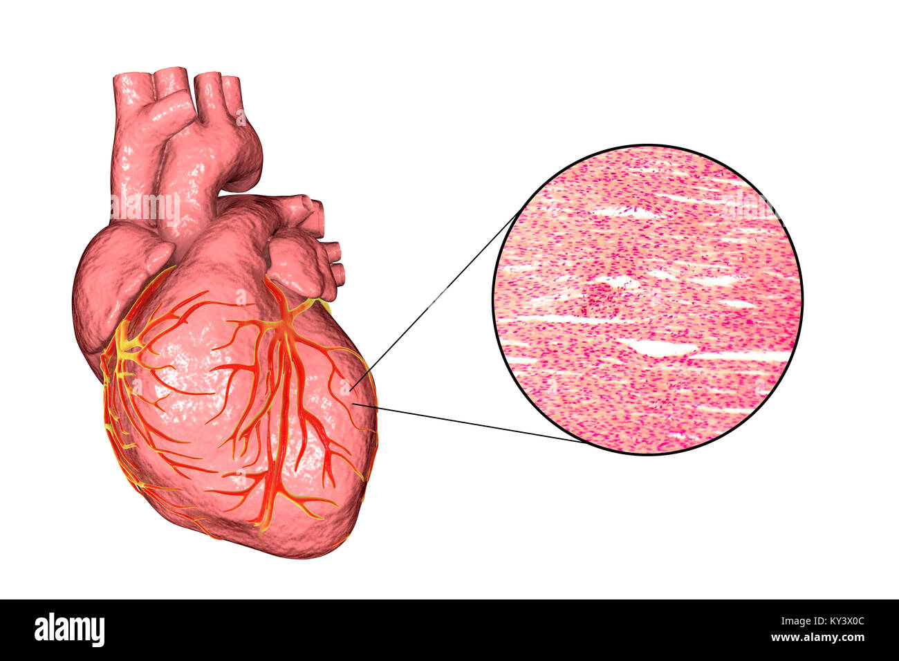 Illustration d'ordinateur d'un coeur humain et de micrographie muscle cardiaque. Muscle cardiaque est composé de cellules en forme de fusée regroupées en faisceaux irréguliers. Les frontières entre les cellules individuelles sont faiblement visibles ici. Chaque cellule contient un noyau, visible comme une tache sombre taché. Le muscle cardiaque est un tissu musculaire qui peuvent contracter régulièrement et continuellement, sans fatigue. Banque D'Images