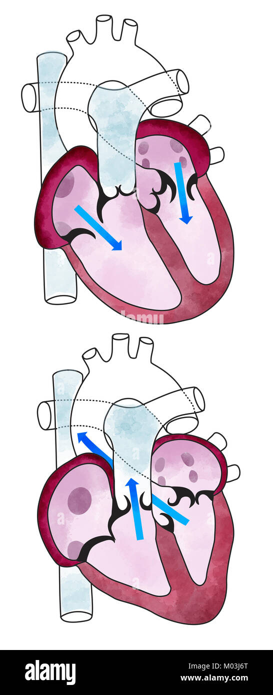 Cœur, ventricules, l'anatomie humaine, les ventricules cardiaques. Corps humain, section Banque D'Images