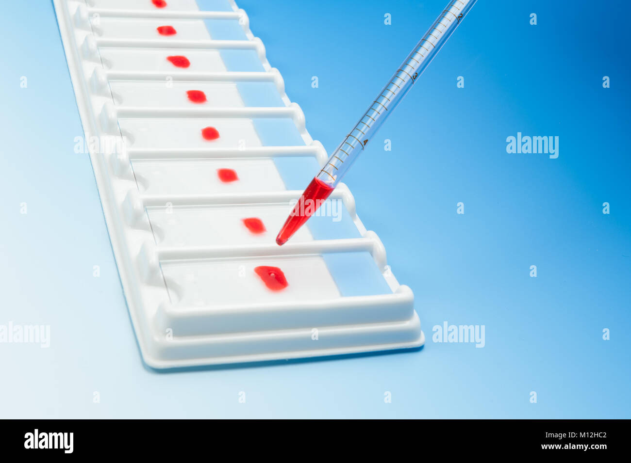 Gamme d'échantillons de sang pour microscopie électronique et d'une pipette sur fond dégradé bleu Banque D'Images