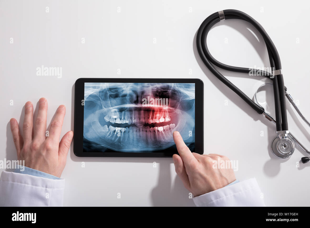 Main du médecin et tablette numérique Écran montrant les dents X-ray avec stéthoscope sur blanc 24 Banque D'Images