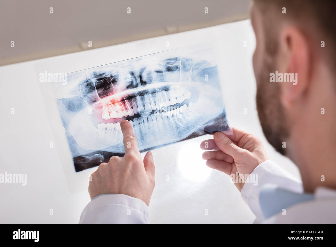 Close-up of a doctor's Hand Holding Dents X-ray Banque D'Images