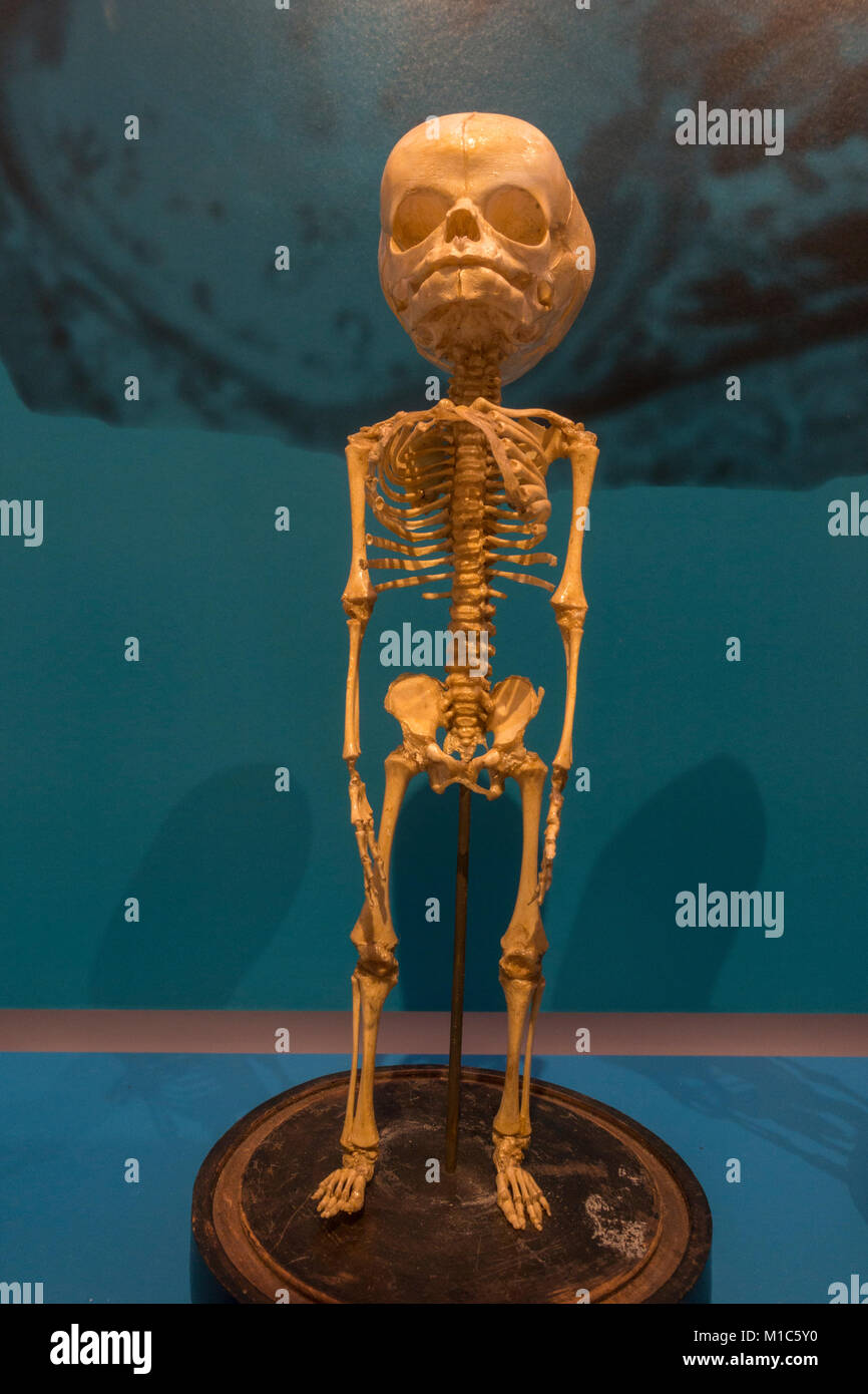 Les droits de l'enfant squelette du fœtus à 7 mois sur l'affichage dans le Musée National de la santé et de la médecine, Silver Spring, MD, USA. Banque D'Images