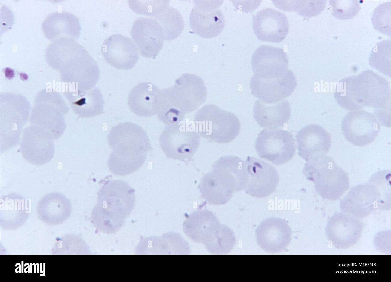 Film mince frottis sanguin montre bague forme Plasmodium falciparum parasites, 1973. Image courtoisie CDC/Dr. Mae Melvin. () Banque D'Images