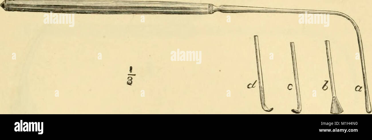 Un manuel des maladies de la gorge et le nez - y compris le pharynx, le larynx, la trachée, l'œsophage, du nez et du pharynx-naso (1880) (14596358397) Banque D'Images