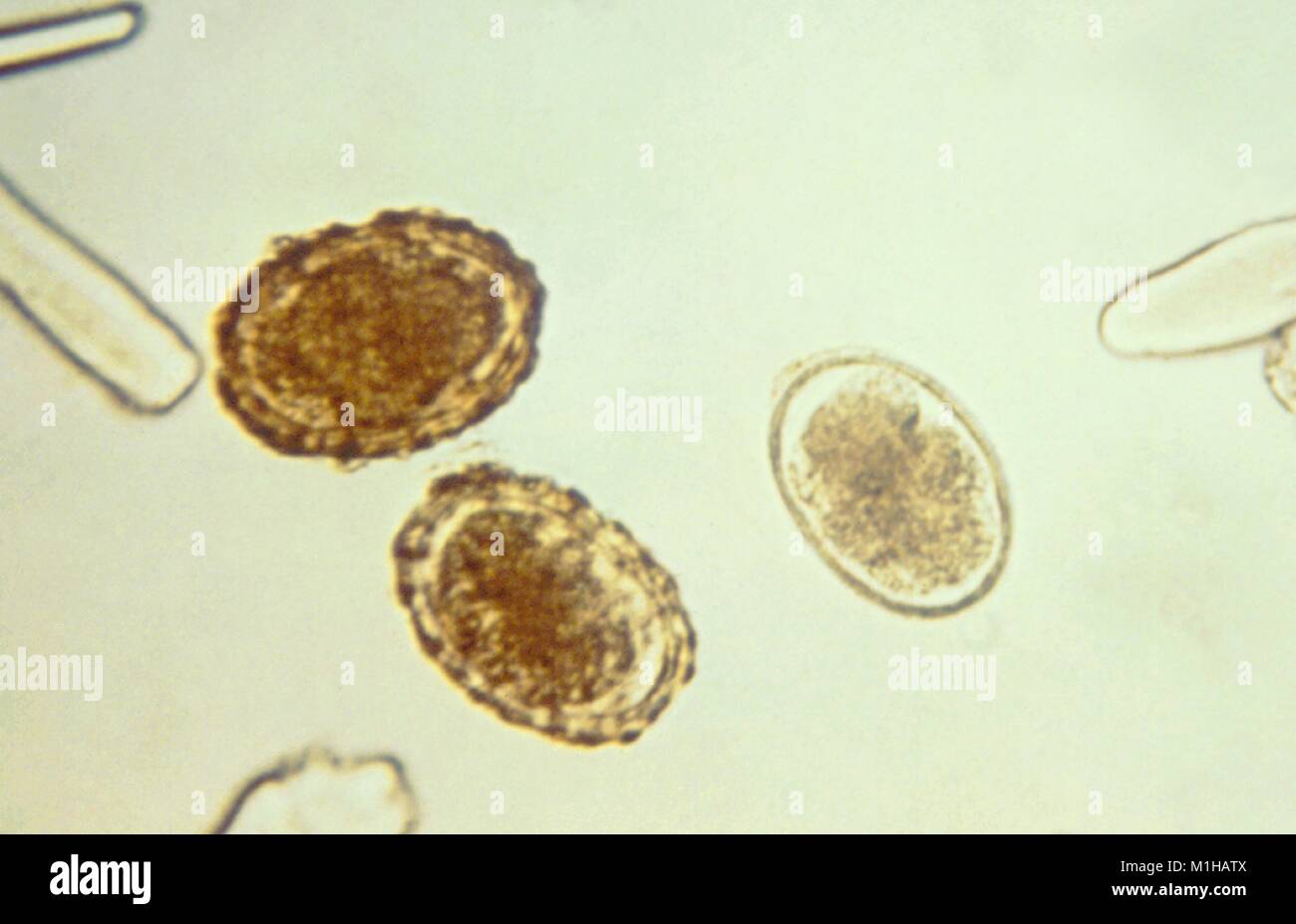 Photomicrographie de trois œufs fécondés Ascaris lumbricoides, un nématode parasite des espèces qui causent la maladie l'ascaridiase, 1979. Image courtoisie CDC. () Banque D'Images