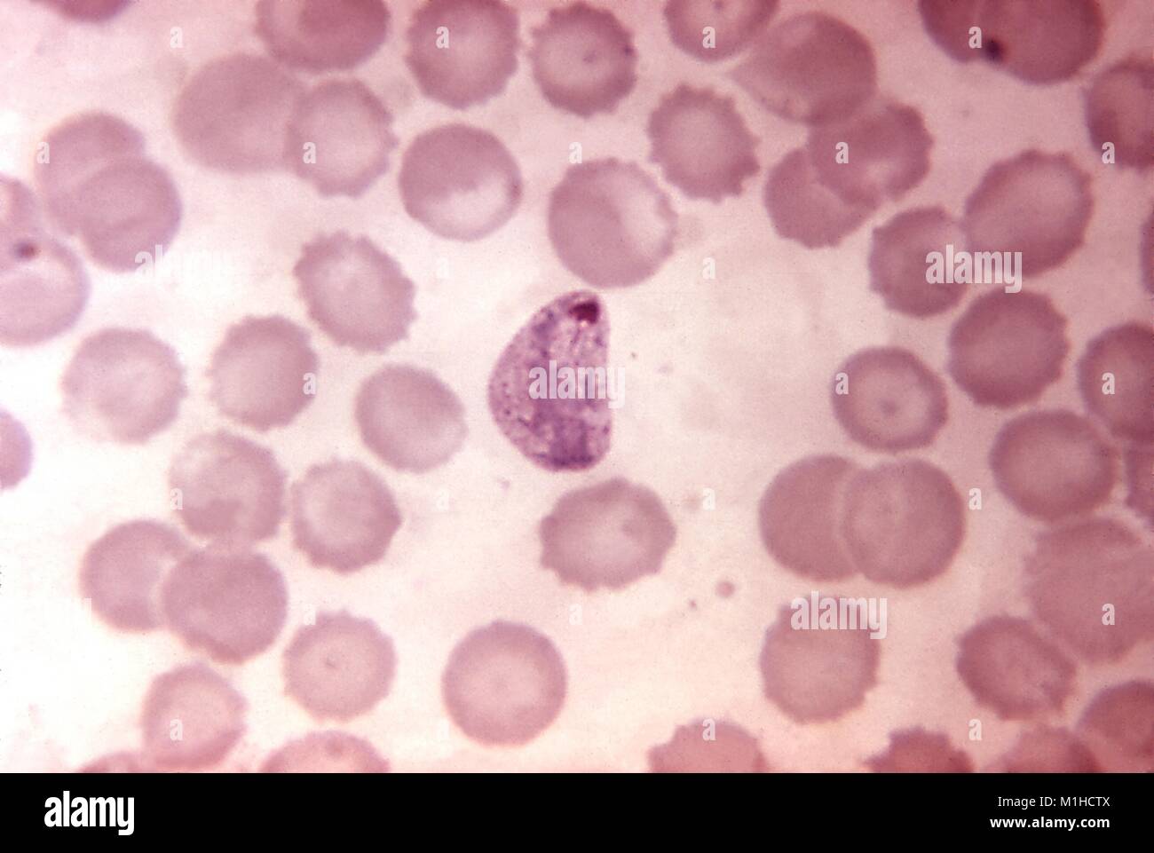 Photomicrographie de plus en plus compacte, Plasmodium vivax trophozoïte, causant le paludisme, un parasite présent sur un frottis sanguin avec Giemsa, amplifié 1250x, 1970. Image courtoisie CDC. () Banque D'Images