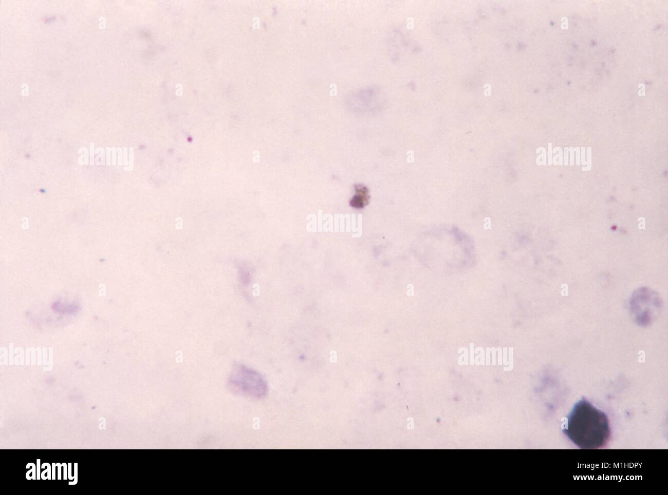 P. falciparum gamétocyte arrondie avec la chromatine visibles et de pigments, mais pas évident cytoplasme, 1966. Image courtoisie CDC/Dr. Mae Melvin. () Banque D'Images