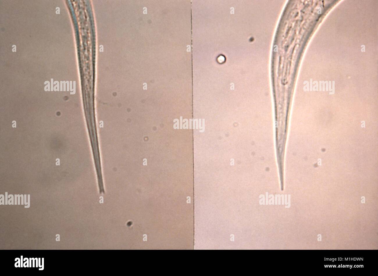 Strongyloides filariform ankylostome et bout de queue révélé dans le film, 1980 micrographie. Image courtoisie Centres for Disease Control (CDC) / Dr Mae Melvin. () Banque D'Images