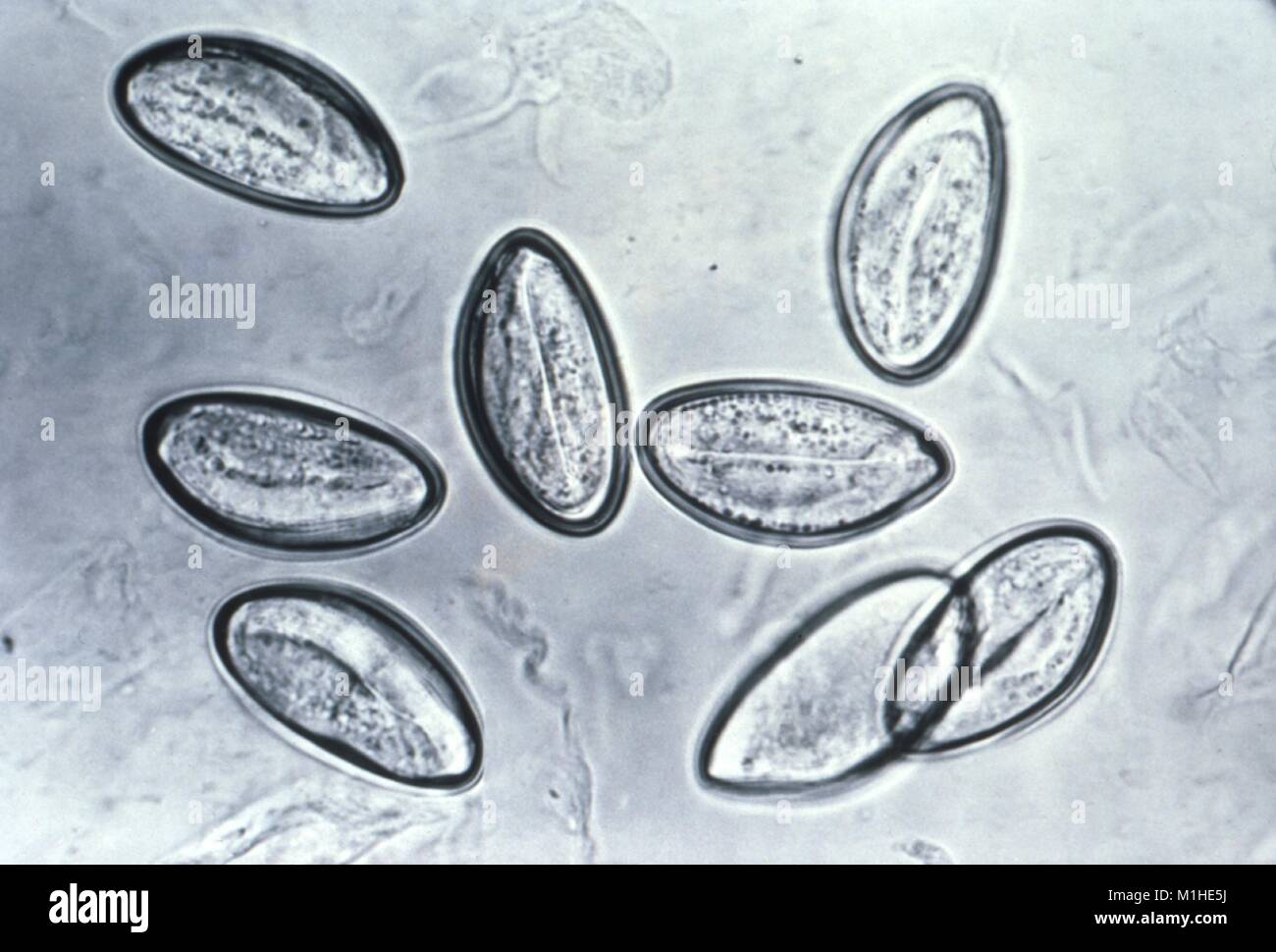 Les vers ronds (Enterobius vermicularis) oeufs de nématodes révèle dans la photomicrographie