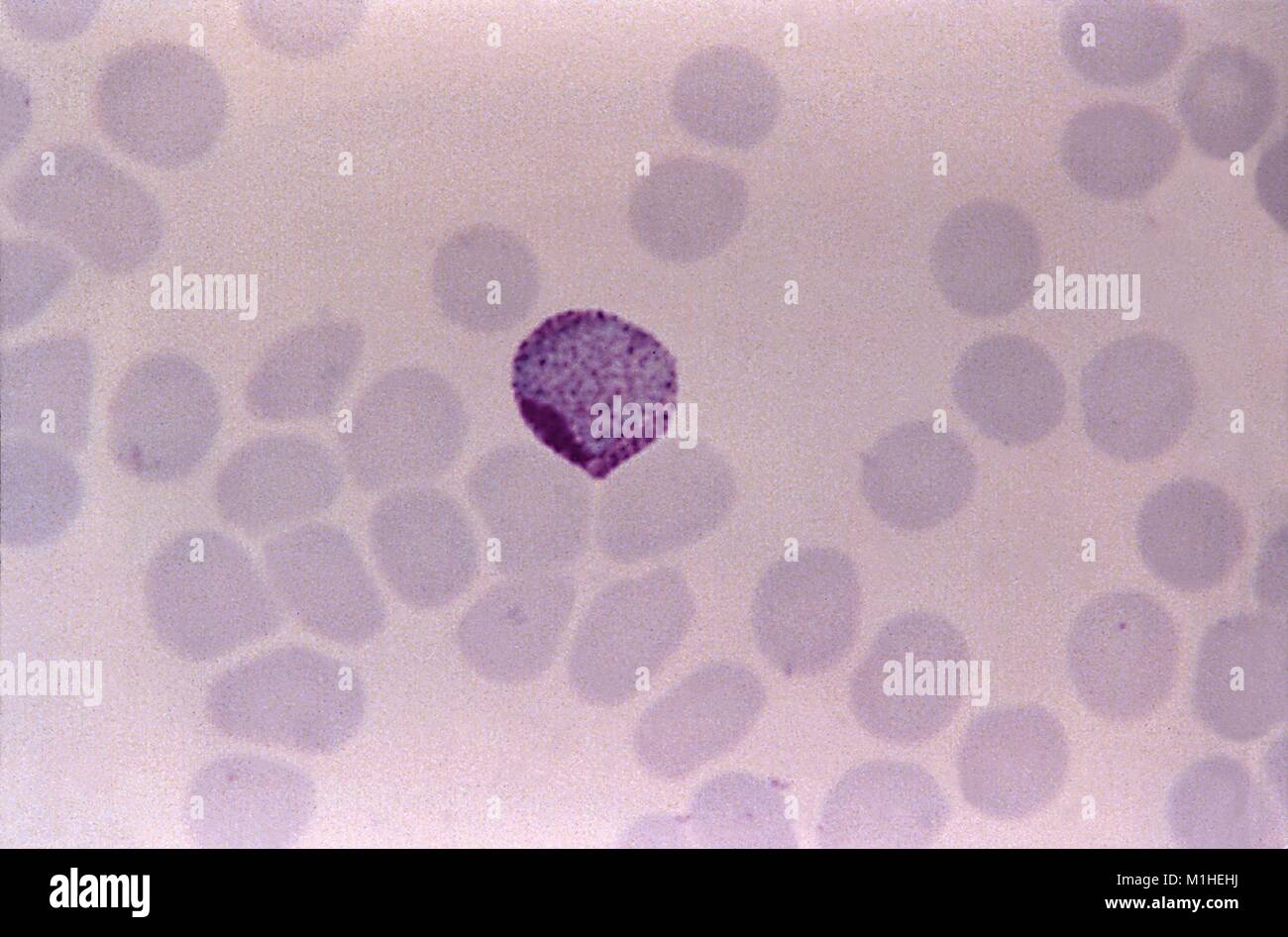 Microphotographie de plasmodium Banque de photographies et d'images à haute  résolution - Alamy