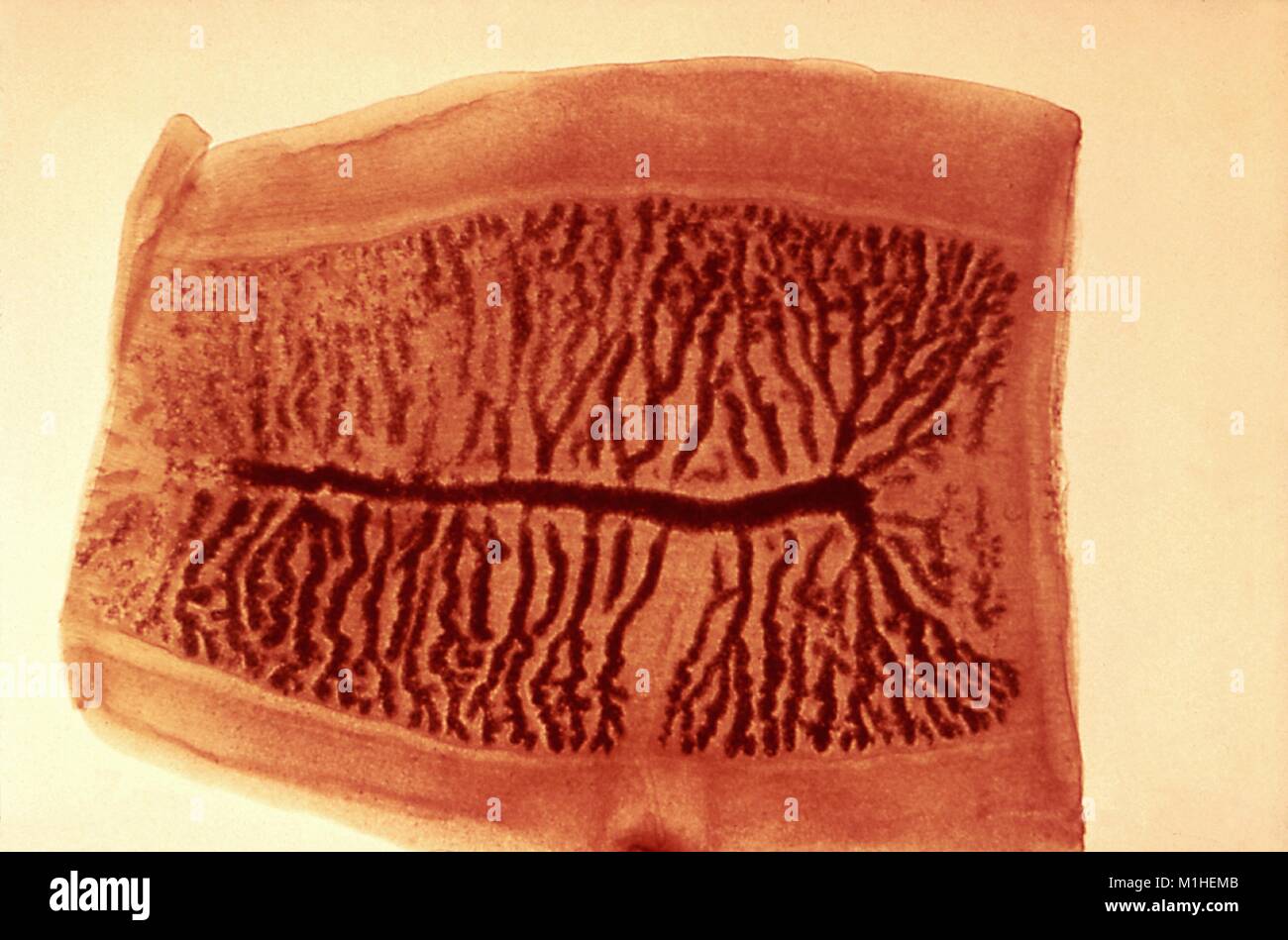 Taenia saginata (ténia) Morphologie d'un proglottis gravides révélé dans le film, 1986. micrograph Image courtoisie Centres for Disease Control (CDC). () Banque D'Images