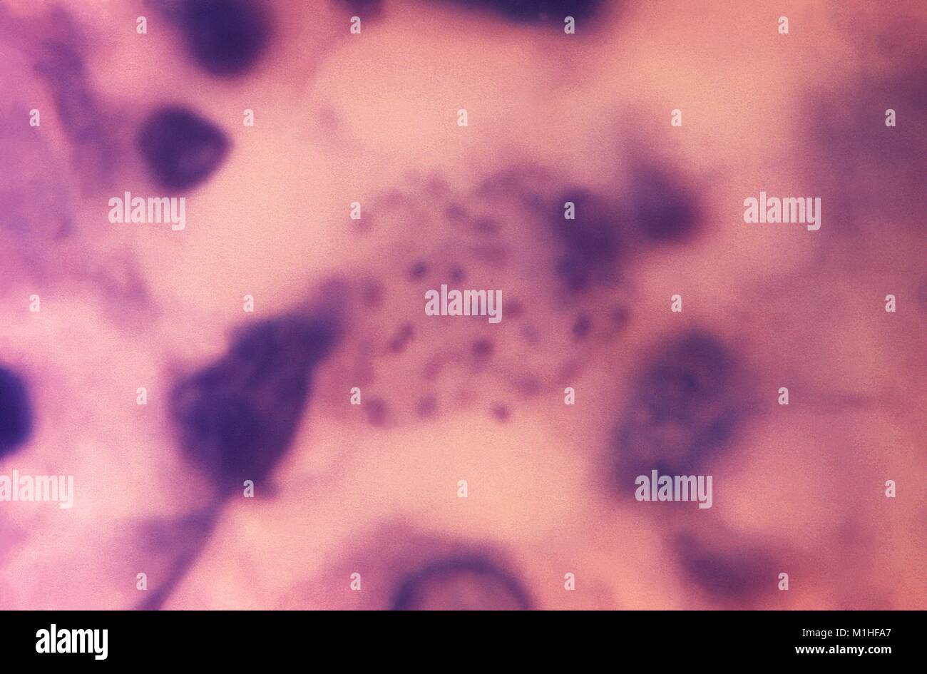 Microphotograph de corps de Donovan, indiquant la maladie transmise sexuellement (Donovanose granulome inguinal), 1971. Image courtoisie CDC/Susan Lindsley. () Banque D'Images