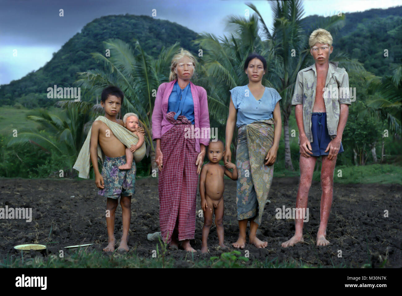 Personnes albinos de Sumbawa, en Indonésie, en Asie Banque D'Images