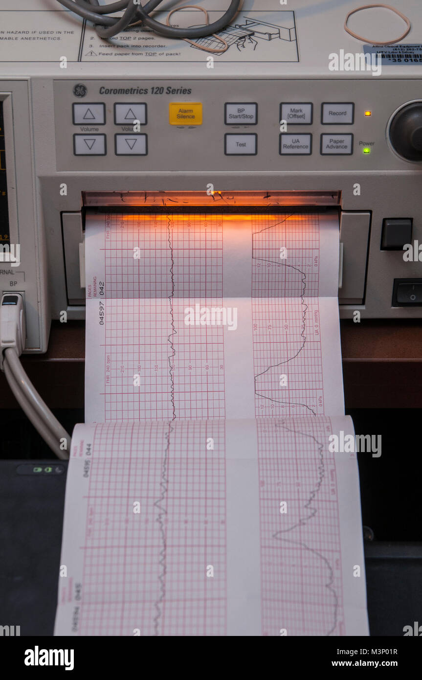 Contractions Monitor Banque D Image Et Photos Alamy Contractions Monitor Banque D Image Et Photos Alamy
