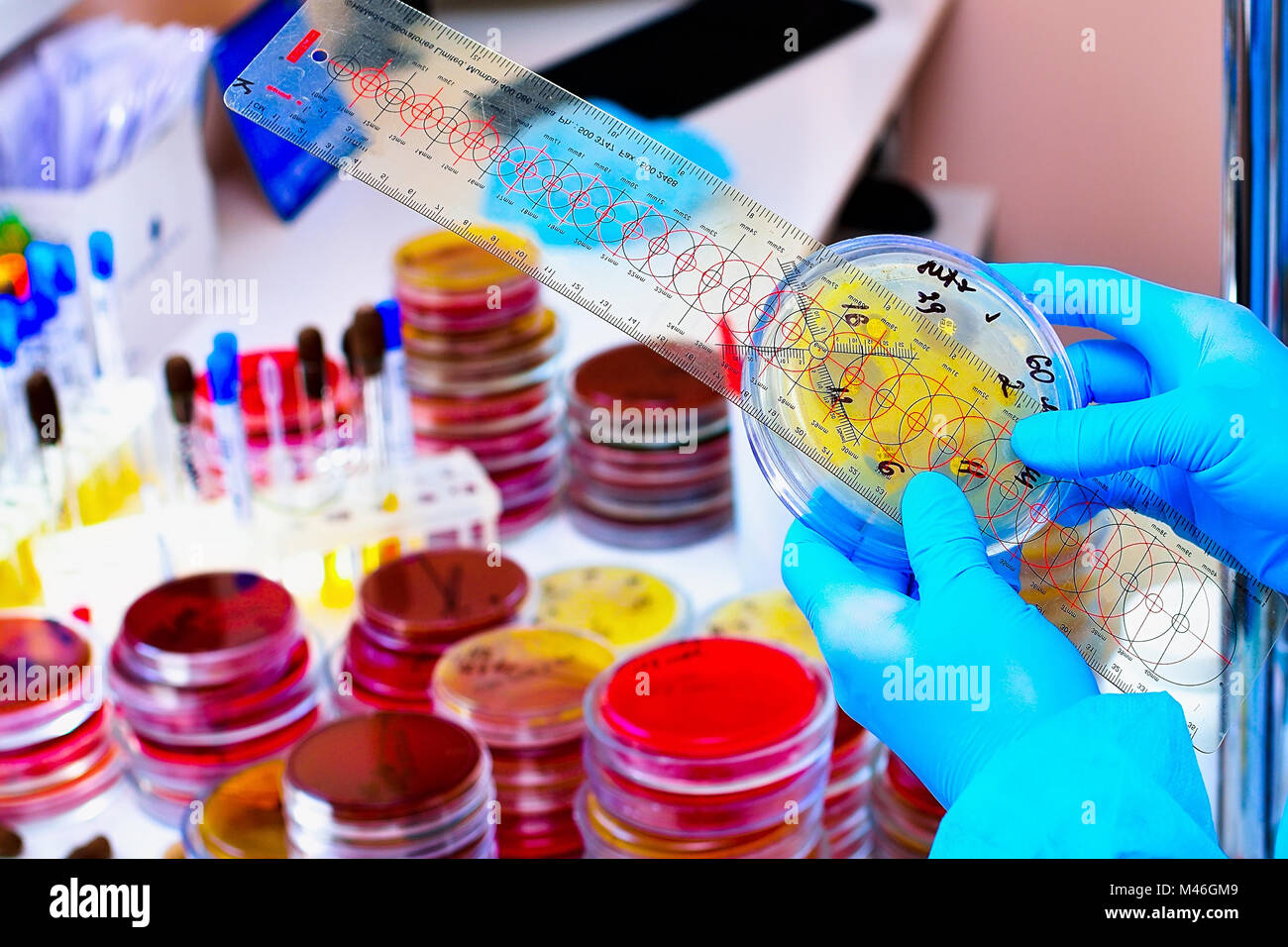 Boîte de Pétri. Laboratoire de microbiologie. Moule et cultures fongiques. La recherche bactérienne Banque D'Images