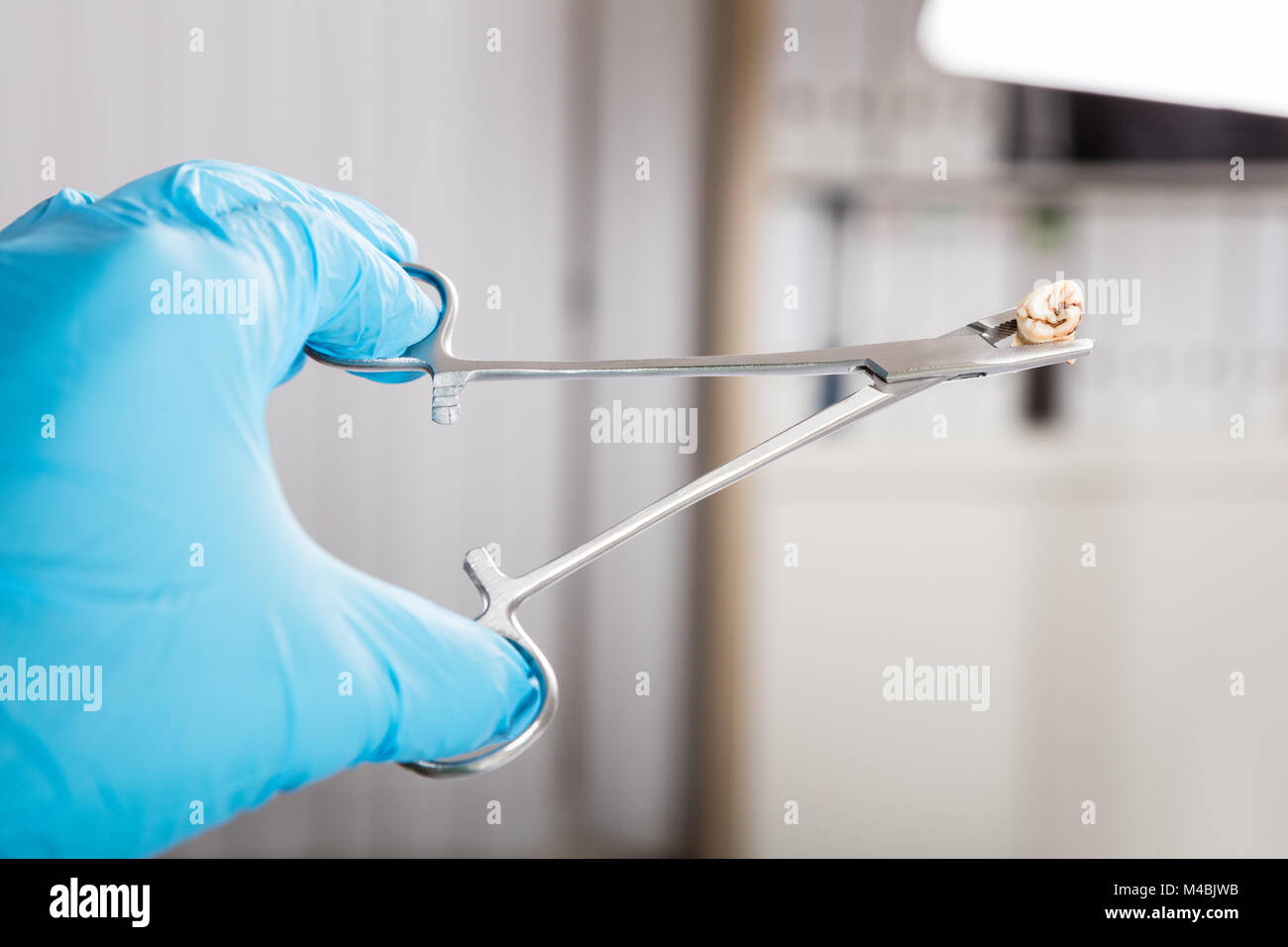 Close-up of Hand Holding Dentiste Dent Carie dentaire avec Tool Banque D'Images