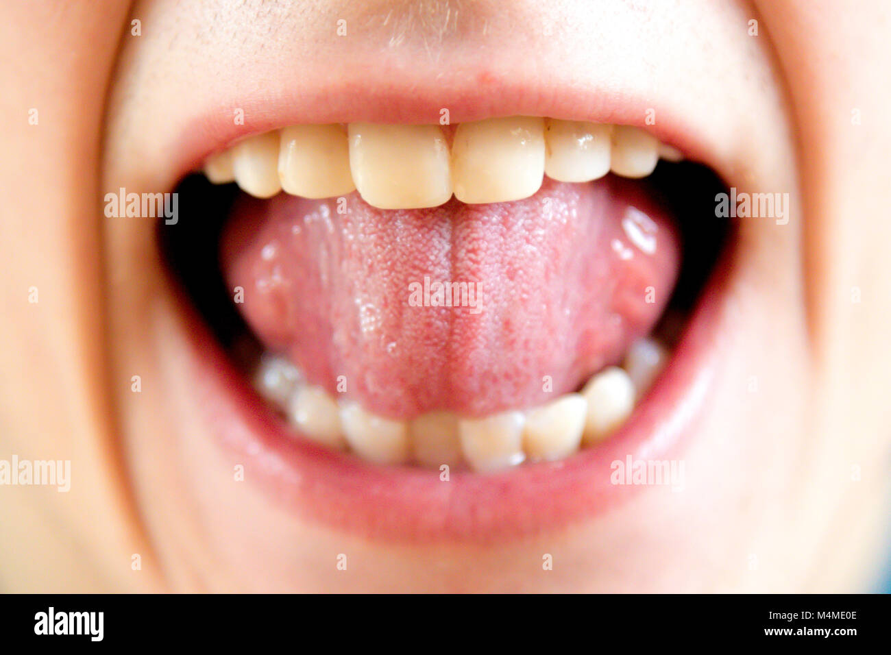 Close up of a woman's face avec la bouche grande ouverte Banque D'Images