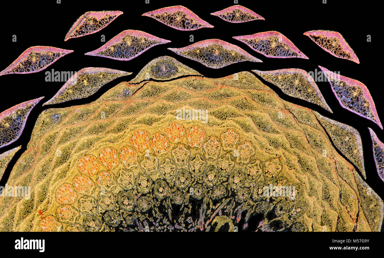 Darkfield photomicrographie, Cirsium vulgare, la lance le chardon, chardon vulgaire, ou chardon commun, rosette détail Banque D'Images