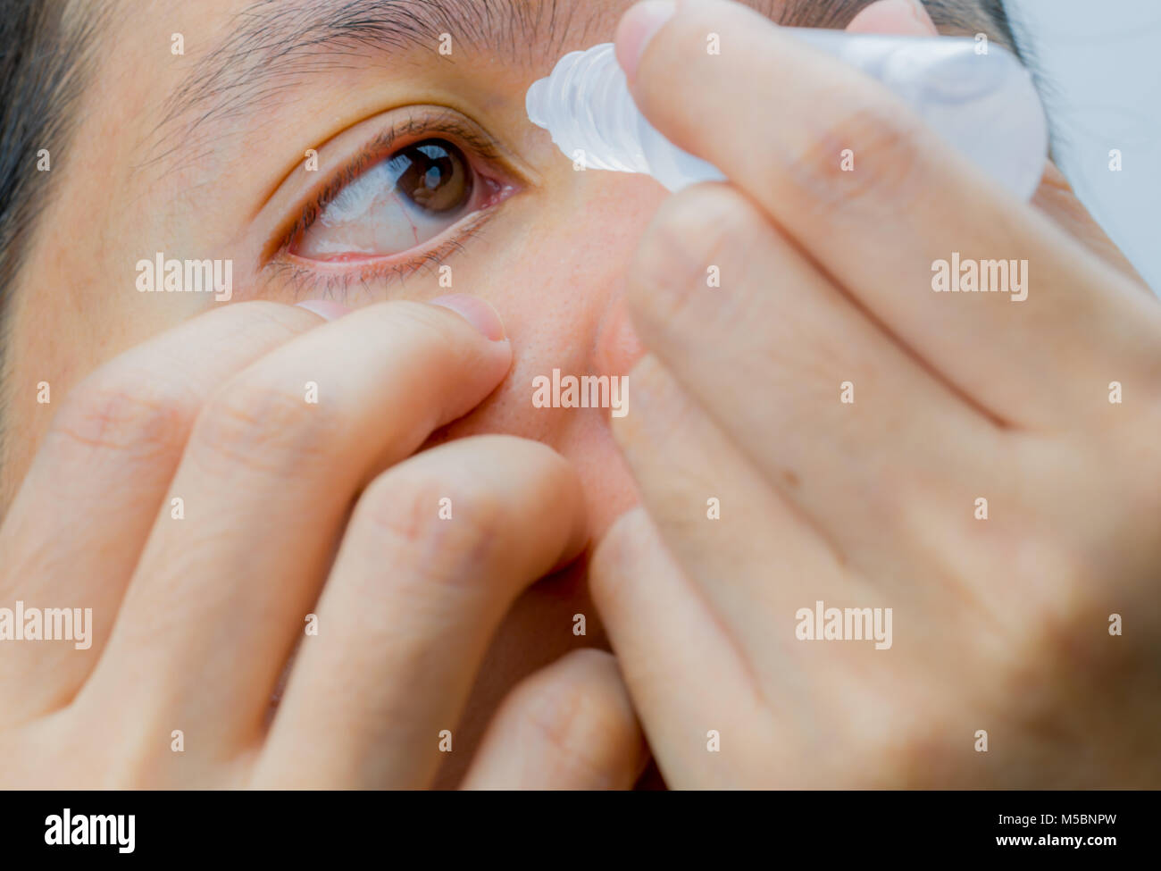 Adult Asian woman applying Eye drops dans ses yeux bruns. Concept de soins oculaires Banque D'Images