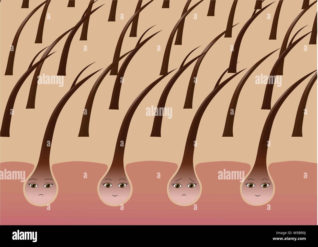 Cartoon follicules de cheveux sur le cuir chevelu souffrant de division se termine Illustration de Vecteur