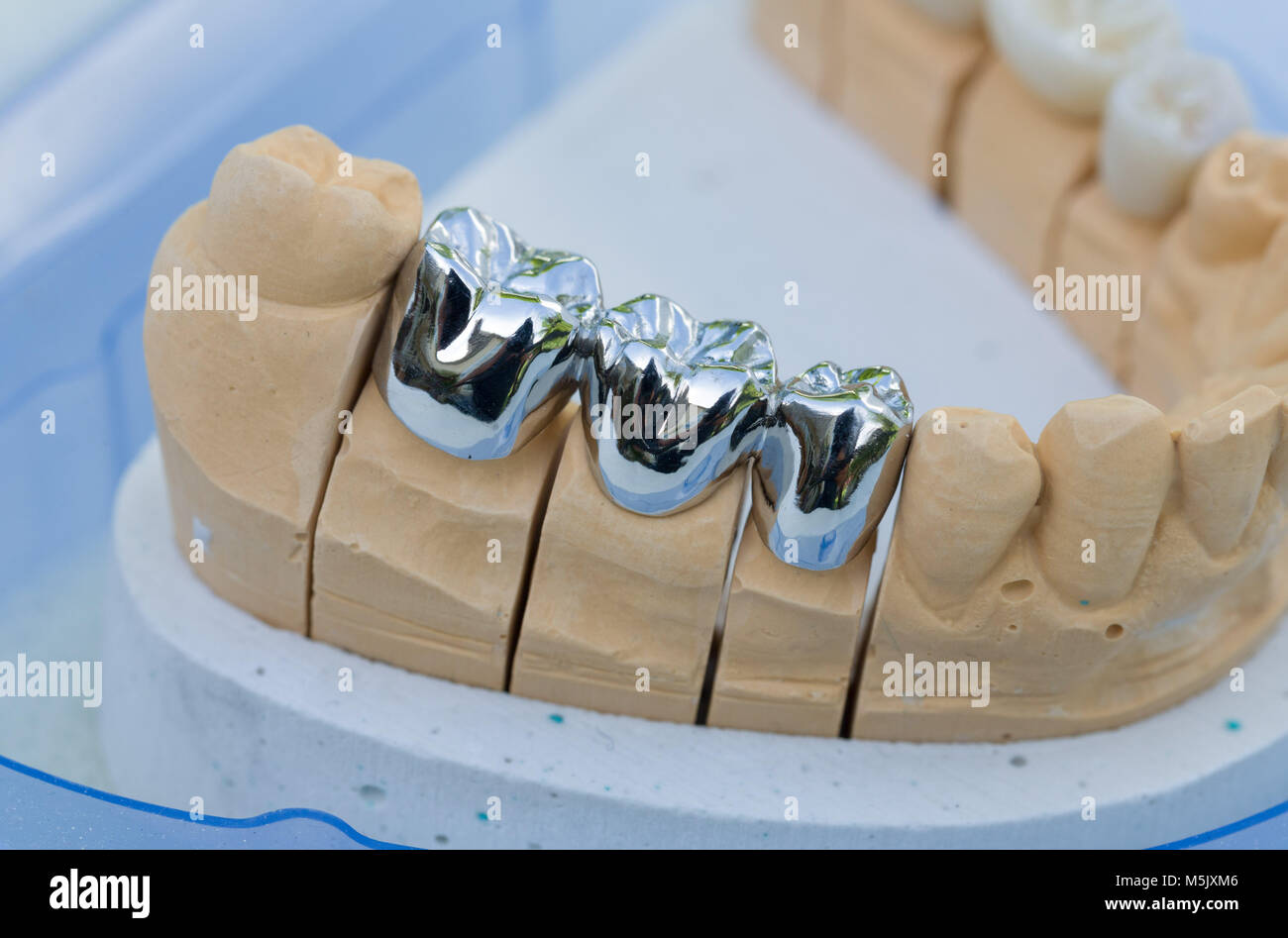 Une prothèse selle avec dentition artificielle dans un laboratoire dentaire Banque D'Images