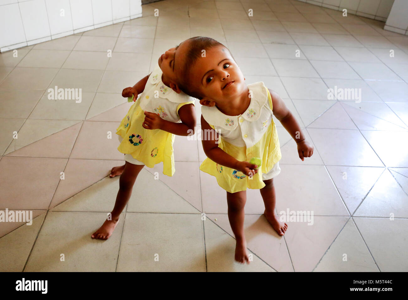 Dhaka, Bangladesh. 26 Février, 2018. Lits jumeaux siamois filles Rabeya l'Islam et l'Islam Rokeya jouer dans un hôpital à Dhaka, au Bangladesh. Taslima Khatun, professeur d'école, a donné une naissance de jumeaux siamois le dirigé le 16 juillet 2016 après une césarienne. Les jumeaux ont été admis à Dhaka medical college hospital pour examen avant la chirurgie potentiellement à séparer leurs têtes. Credit : SK Hasan Ali/Alamy Live News Banque D'Images