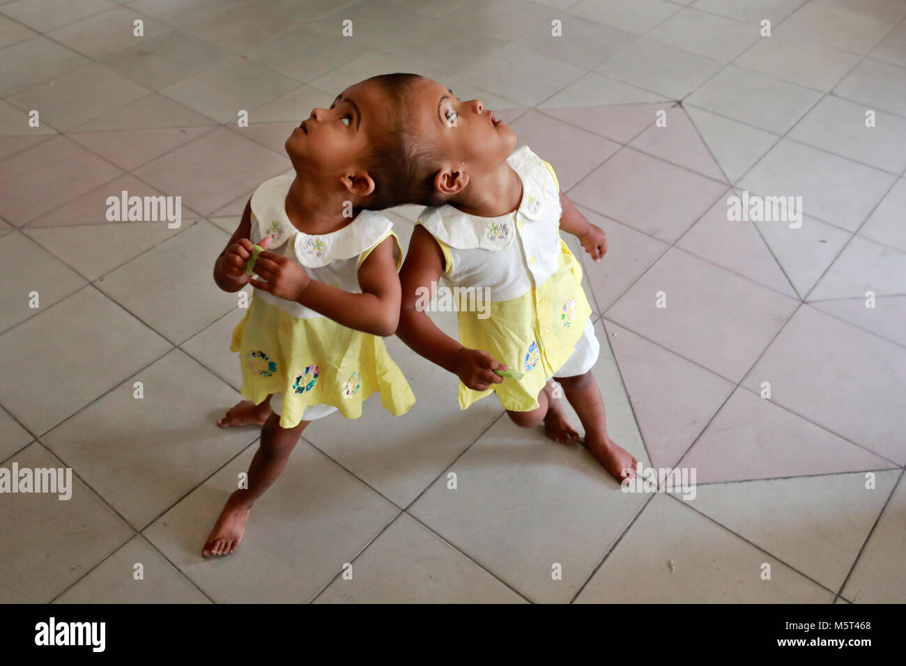 Dhaka, Bangladesh. 26 Février, 2018. Lits jumeaux siamois filles Rabeya l'Islam et l'Islam Rokeya jouer dans un hôpital à Dhaka, au Bangladesh. Taslima Khatun, professeur d'école, a donné une naissance de jumeaux siamois le dirigé le 16 juillet 2016 après une césarienne. Les jumeaux ont été admis à Dhaka medical college hospital pour examen avant la chirurgie potentiellement à séparer leurs têtes. Credit : SK Hasan Ali/Alamy Live News Banque D'Images