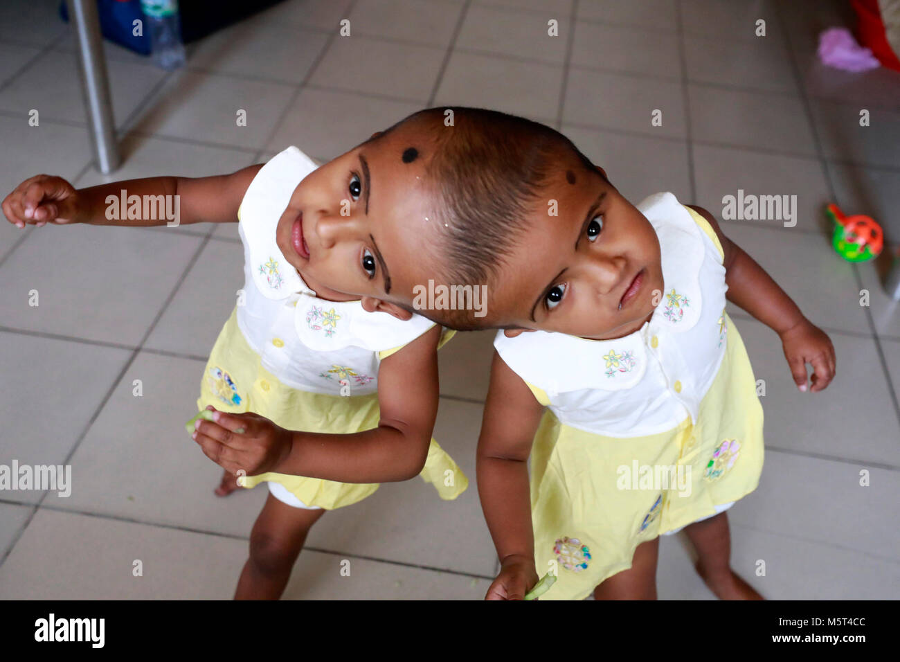 Dhaka, Bangladesh. 26 Février, 2018. Lits jumeaux siamois filles Rabeya l'Islam et l'Islam Rokeya jouer dans un hôpital à Dhaka, au Bangladesh. Taslima Khatun, professeur d'école, a donné une naissance de jumeaux siamois le dirigé le 16 juillet 2016 après une césarienne. Les jumeaux ont été admis à Dhaka medical college hospital pour examen avant la chirurgie potentiellement à séparer leurs têtes. Credit : SK Hasan Ali/Alamy Live News Banque D'Images