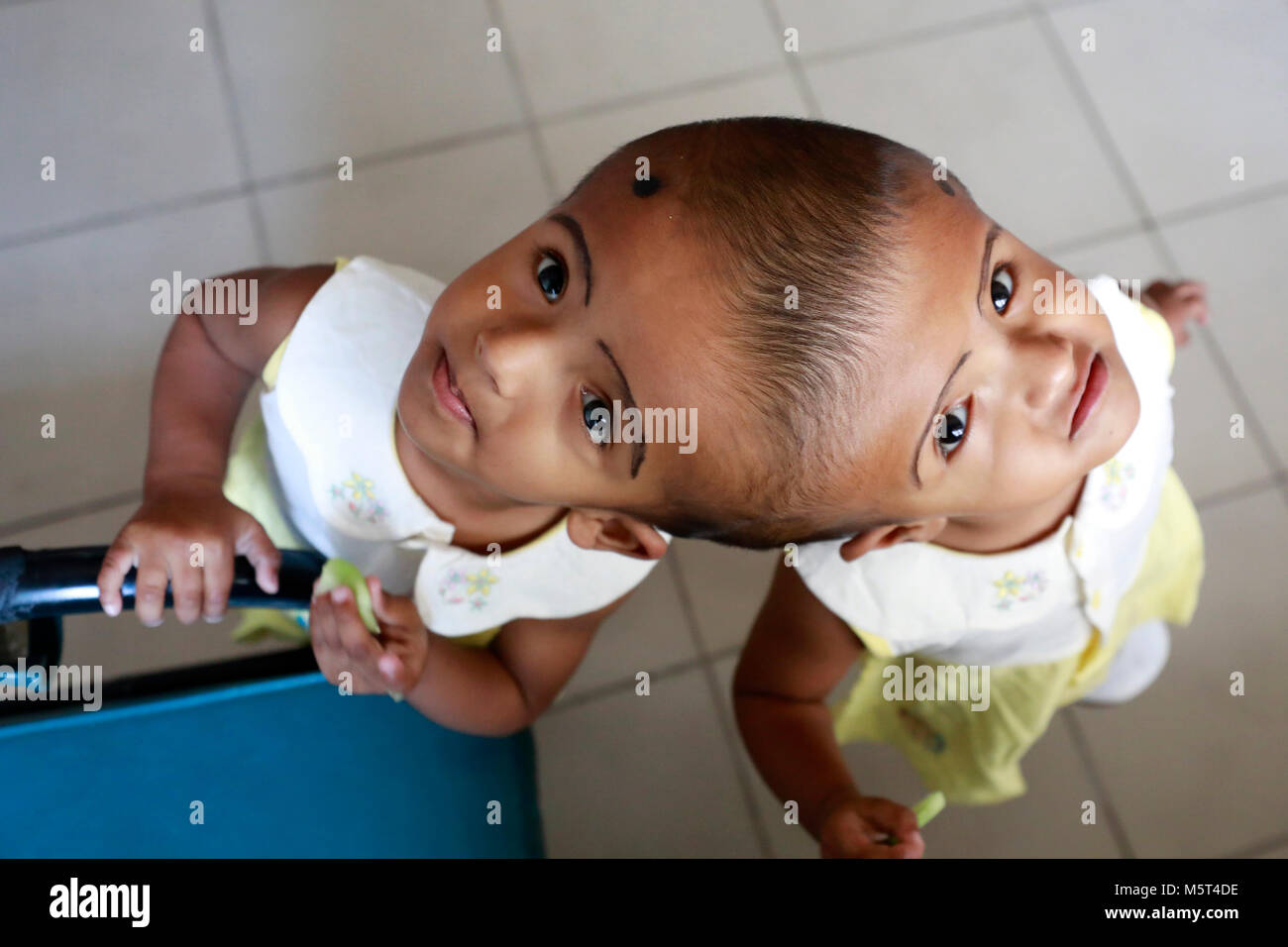 Dhaka, Bangladesh. 26 Février, 2018. Lits jumeaux siamois filles Rabeya l'Islam et l'Islam Rokeya jouer dans un hôpital à Dhaka, au Bangladesh. Taslima Khatun, professeur d'école, a donné une naissance de jumeaux siamois le dirigé le 16 juillet 2016 après une césarienne. Les jumeaux ont été admis à Dhaka medical college hospital pour examen avant la chirurgie potentiellement à séparer leurs têtes. Credit : SK Hasan Ali/Alamy Live News Banque D'Images
