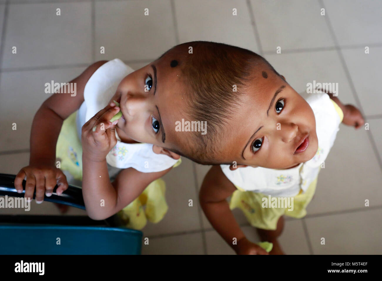 Dhaka, Bangladesh. 26 Février, 2018. Lits jumeaux siamois filles Rabeya l'Islam et l'Islam Rokeya jouer dans un hôpital à Dhaka, au Bangladesh. Taslima Khatun, professeur d'école, a donné une naissance de jumeaux siamois le dirigé le 16 juillet 2016 après une césarienne. Les jumeaux ont été admis à Dhaka medical college hospital pour examen avant la chirurgie potentiellement à séparer leurs têtes. Credit : SK Hasan Ali/Alamy Live News Banque D'Images