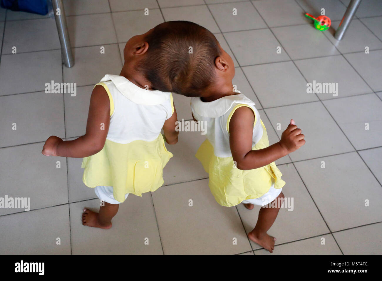 Dhaka, Bangladesh. 26 Février, 2018. Lits jumeaux siamois filles Rabeya l'Islam et l'Islam Rokeya jouer dans un hôpital à Dhaka, au Bangladesh. Taslima Khatun, professeur d'école, a donné une naissance de jumeaux siamois le dirigé le 16 juillet 2016 après une césarienne. Les jumeaux ont été admis à Dhaka medical college hospital pour examen avant la chirurgie potentiellement à séparer leurs têtes. Credit : SK Hasan Ali/Alamy Live News Banque D'Images