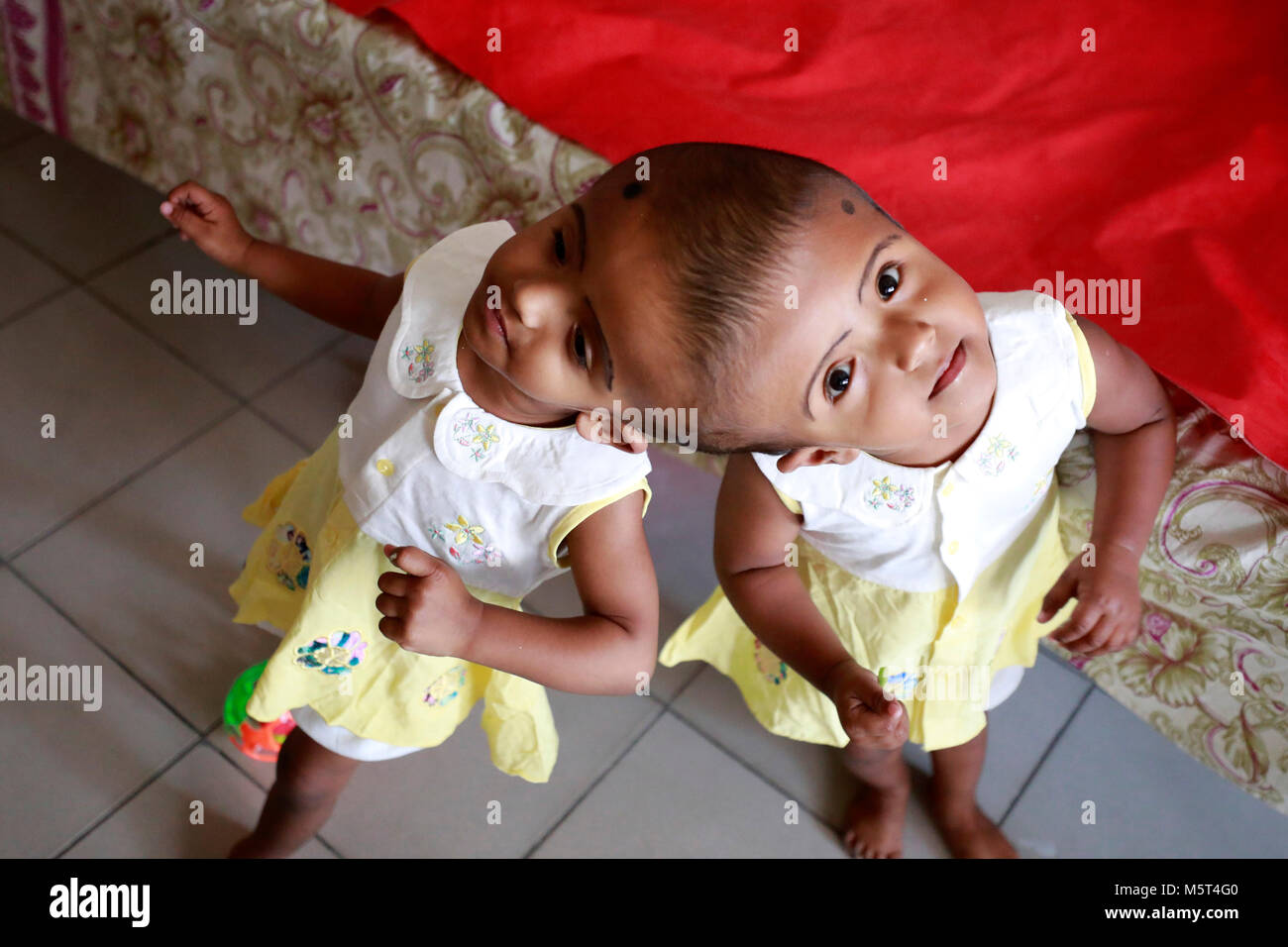 Dhaka, Bangladesh. 26 Février, 2018. Lits jumeaux siamois filles Rabeya l'Islam et l'Islam Rokeya jouer dans un hôpital à Dhaka, au Bangladesh. Taslima Khatun, professeur d'école, a donné une naissance de jumeaux siamois le dirigé le 16 juillet 2016 après une césarienne. Les jumeaux ont été admis à Dhaka medical college hospital pour examen avant la chirurgie potentiellement à séparer leurs têtes. Credit : SK Hasan Ali/Alamy Live News Banque D'Images