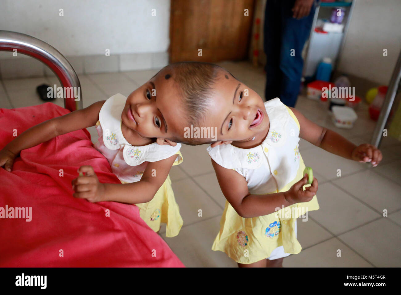 Dhaka, Bangladesh. 26 Février, 2018. Lits jumeaux siamois filles Rabeya l'Islam et l'Islam Rokeya jouer dans un hôpital à Dhaka, au Bangladesh. Taslima Khatun, professeur d'école, a donné une naissance de jumeaux siamois le dirigé le 16 juillet 2016 après une césarienne. Les jumeaux ont été admis à Dhaka medical college hospital pour examen avant la chirurgie potentiellement à séparer leurs têtes. Credit : SK Hasan Ali/Alamy Live News Banque D'Images