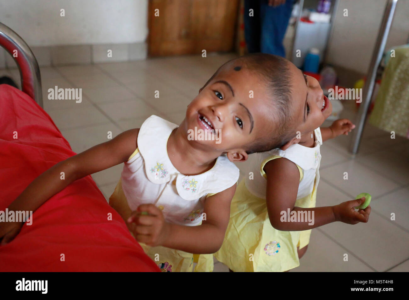 Dhaka, Bangladesh. 26 Février, 2018. Lits jumeaux siamois filles Rabeya l'Islam et l'Islam Rokeya jouer dans un hôpital à Dhaka, au Bangladesh. Taslima Khatun, professeur d'école, a donné une naissance de jumeaux siamois le dirigé le 16 juillet 2016 après une césarienne. Les jumeaux ont été admis à Dhaka medical college hospital pour examen avant la chirurgie potentiellement à séparer leurs têtes. Credit : SK Hasan Ali/Alamy Live News Banque D'Images