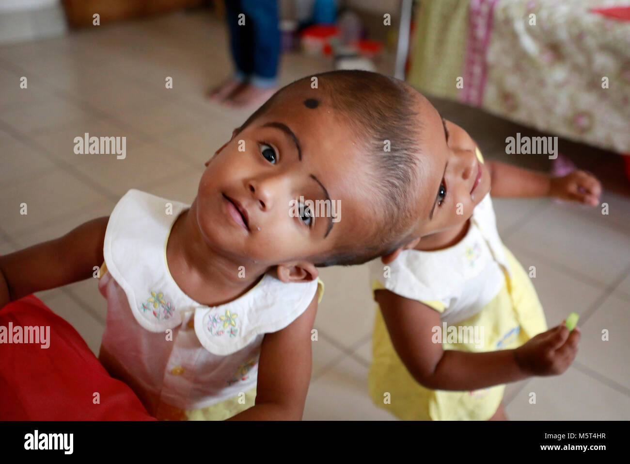 Dhaka, Bangladesh. 26 Février, 2018. Lits jumeaux siamois filles Rabeya l'Islam et l'Islam Rokeya jouer dans un hôpital à Dhaka, au Bangladesh. Taslima Khatun, professeur d'école, a donné une naissance de jumeaux siamois le dirigé le 16 juillet 2016 après une césarienne. Les jumeaux ont été admis à Dhaka medical college hospital pour examen avant la chirurgie potentiellement à séparer leurs têtes. Credit : SK Hasan Ali/Alamy Live News Banque D'Images