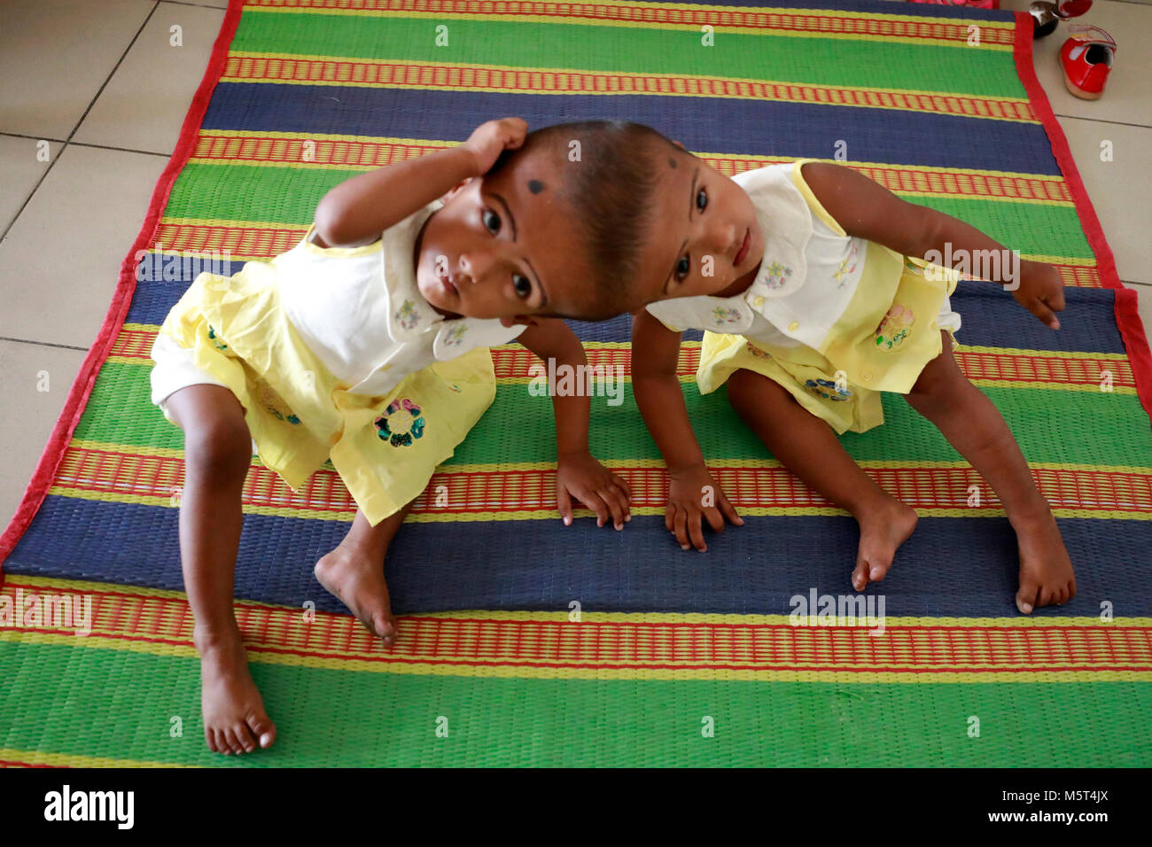 Dhaka, Bangladesh. 26 Février, 2018. Lits jumeaux siamois filles Rabeya l'Islam et l'Islam Rokeya jouer dans un hôpital à Dhaka, au Bangladesh. Taslima Khatun, professeur d'école, a donné une naissance de jumeaux siamois le dirigé le 16 juillet 2016 après une césarienne. Les jumeaux ont été admis à Dhaka medical college hospital pour examen avant la chirurgie potentiellement à séparer leurs têtes. Credit : SK Hasan Ali/Alamy Live News Banque D'Images