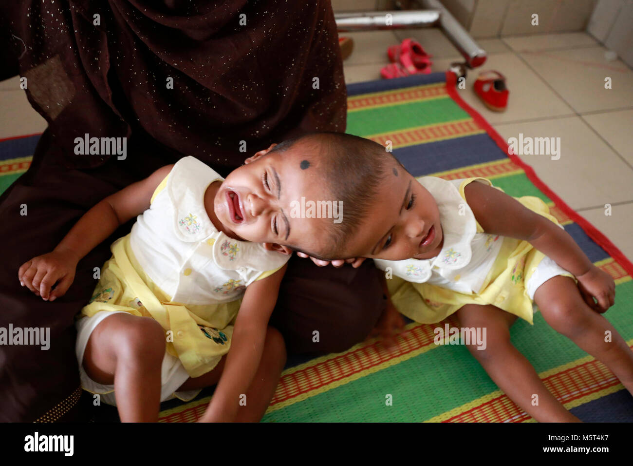 Dhaka, Bangladesh. 26 Février, 2018. Lits jumeaux siamois filles Rabeya l'Islam et l'Islam Rokeya jouer dans un hôpital à Dhaka, au Bangladesh. Taslima Khatun, professeur d'école, a donné une naissance de jumeaux siamois le dirigé le 16 juillet 2016 après une césarienne. Les jumeaux ont été admis à Dhaka medical college hospital pour examen avant la chirurgie potentiellement à séparer leurs têtes. Credit : SK Hasan Ali/Alamy Live News Banque D'Images