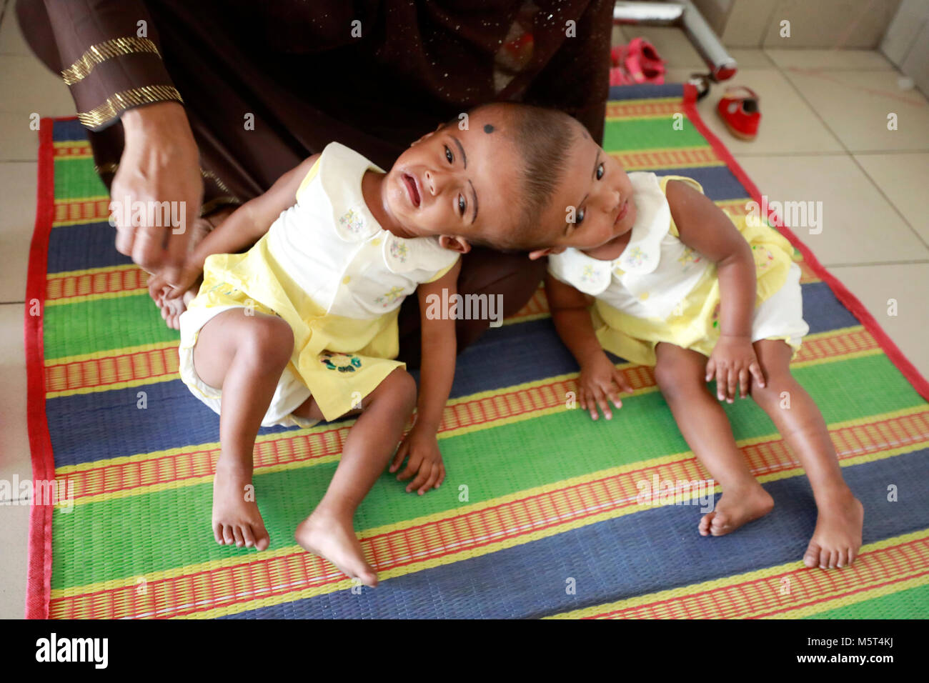 Dhaka, Bangladesh. 26 Février, 2018. Lits jumeaux siamois filles Rabeya l'Islam et l'Islam Rokeya jouer dans un hôpital à Dhaka, au Bangladesh. Taslima Khatun, professeur d'école, a donné une naissance de jumeaux siamois le dirigé le 16 juillet 2016 après une césarienne. Les jumeaux ont été admis à Dhaka medical college hospital pour examen avant la chirurgie potentiellement à séparer leurs têtes. Credit : SK Hasan Ali/Alamy Live News Banque D'Images