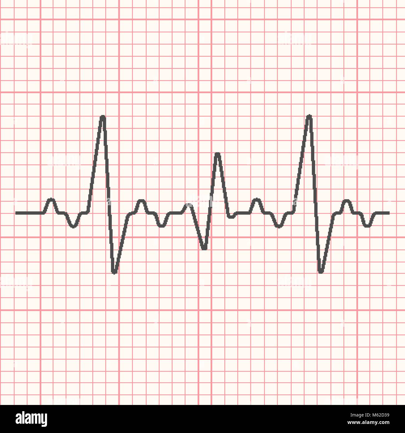 Illustration sur la ligne noire cardiogramme médical grille rouge Illustration de Vecteur